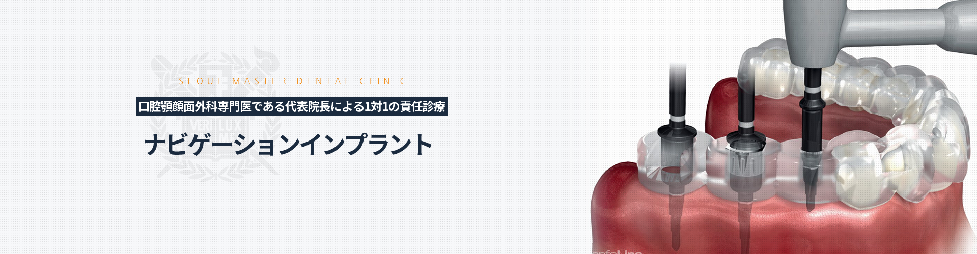 구강악안면외과-전문의-대표원장-1:1-책임관리-네비게이션-임플란트