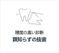 사랑니발치